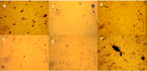 StemCellViability5daysculture